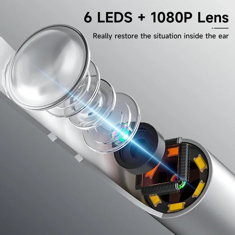 Wireless Smart Visual Ear Cleaner – 1296P HD Camera & LED Lights